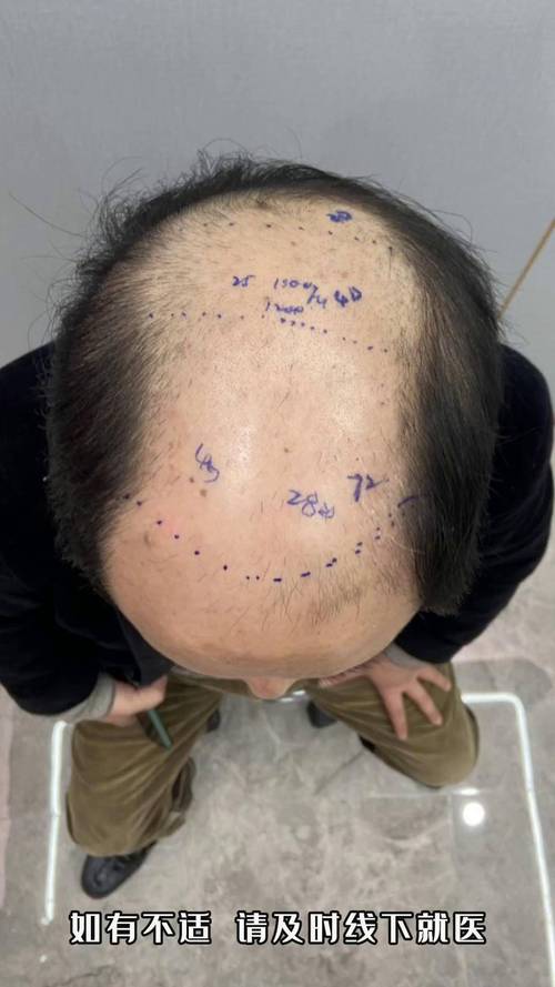 定向增发是怎么回事,定向增发是什么意思?-第2张图片-博通理财 定向增发是怎么回事,定向增发是什么意思?-第2张图片-博通理财